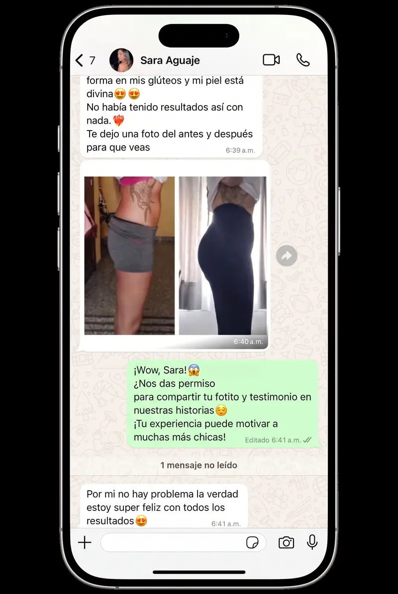 Chat de WhatsApp: resultados en glúteos y piel, antes y después