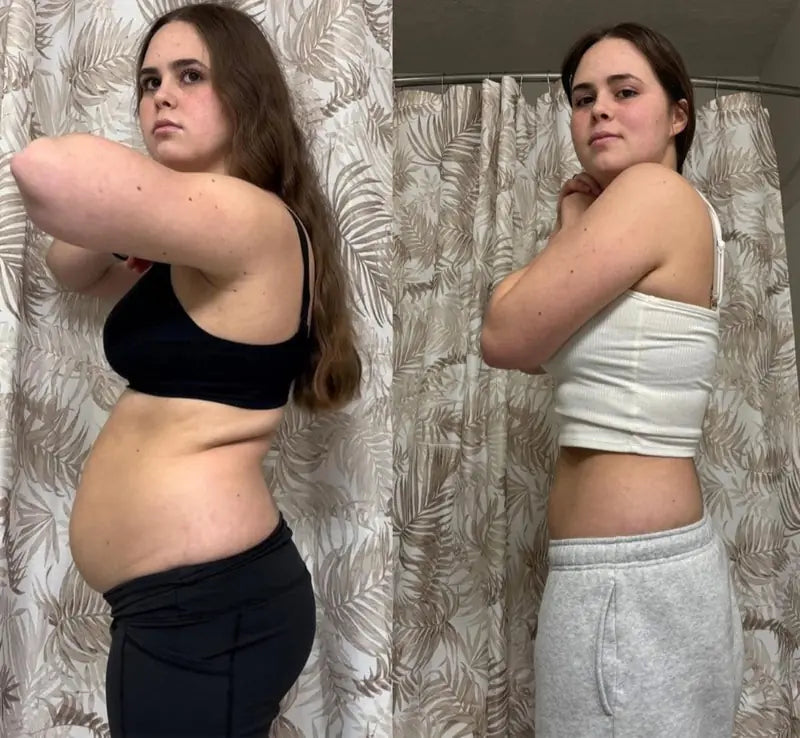 Antes y después de Sara F. con Linfovit