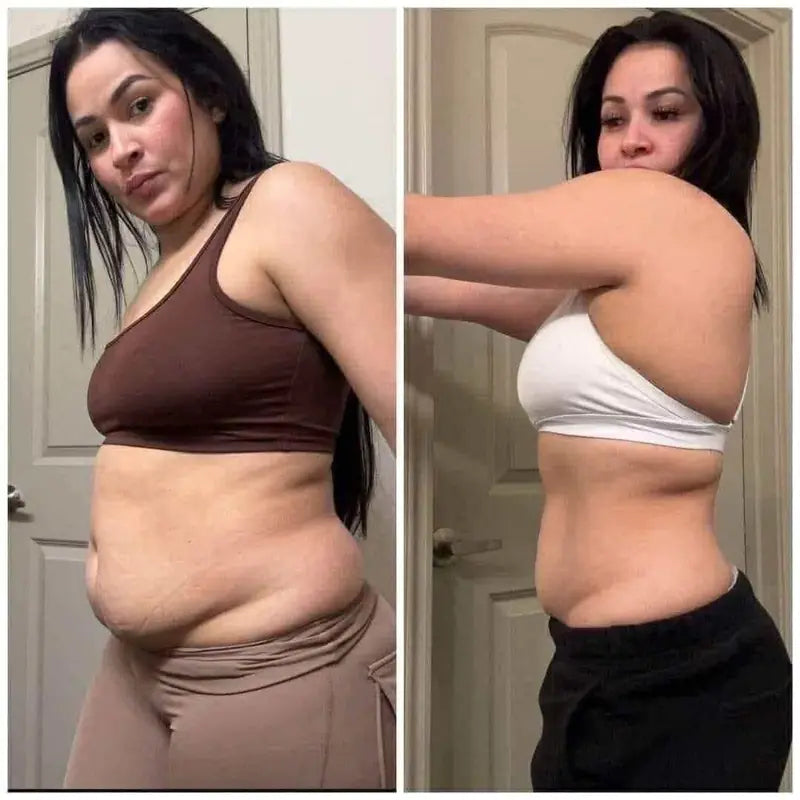 Antes y después de Paola T. con Linfovit