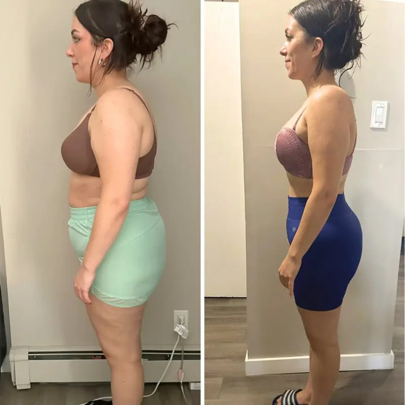 Antes y después de Malaika N. con Linfovit